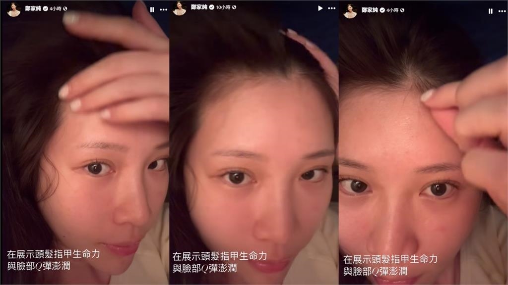 鄭家純大素顏撩髮「翻開真實髮際線」！15秒反差片流出震撼84萬粉
