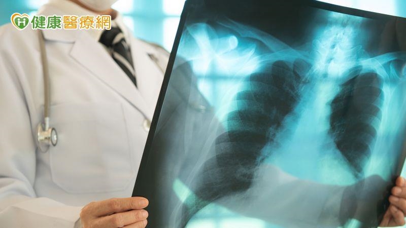 沒抽菸卻得肺癌？醫親解真相：基因突變和環境因素是關鍵！　