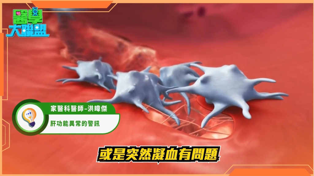 B肝罹癌機率飆高20倍!醫揭「慢性發炎路徑」:纖維化、肝硬化、肝癌