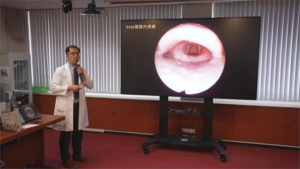 睡眠品質大提升！　達文西止鼾手術改善打呼困擾