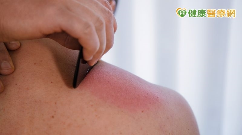 炎炎夏日氣溫持續高升 中醫師教你「消暑撇步」預防熱傷害