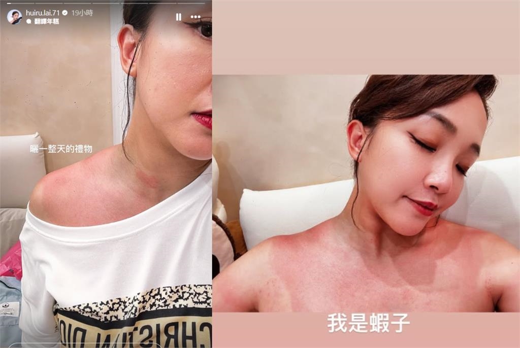 《好運來》賴慧如才喊再婚喜訊!突流出「整尊變紅蝦」超敬業身影震撼3萬網