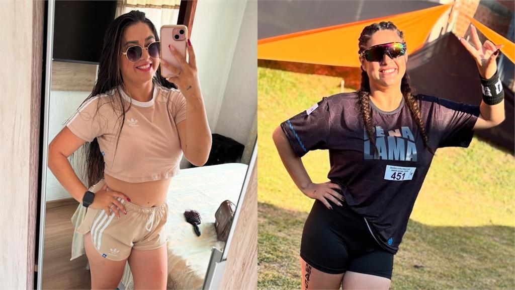 巴西22歲少女苦頂「12公斤巨胸」 患巨乳症募資縮胸10kg重拾自信