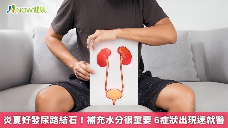炎夏好發尿路結石！補充水分很重要 6症狀出現速就醫