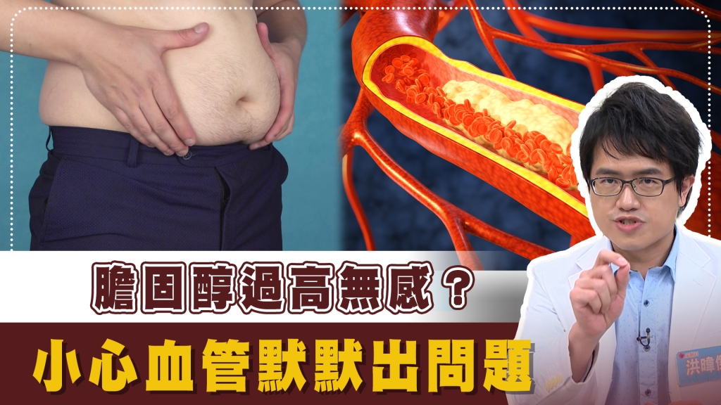 健檢「紅字」看不懂？如何遠離中風？　醫揭「好、壞膽固醇」關鍵數字！ 