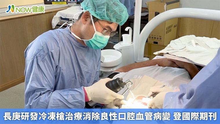 長庚研發冷凍槍治療消除良性口腔血管病變 登國際期刊