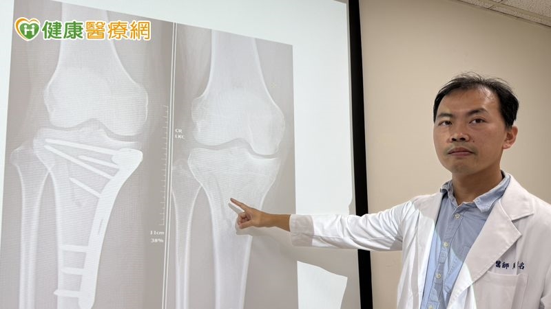 逛街途中突遭車撞！　她靠「這套治療組合」提升癒合效率