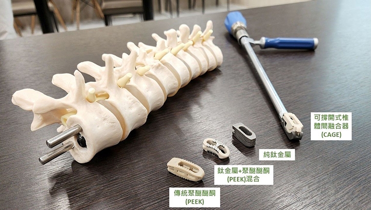 脊椎微創手術再進化！傷口小更安全 醫曝3種族群適用
