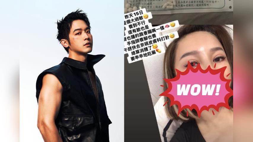 王彩樺「嘴唇腫成香腸」真相曝！現身惹「整形疑雲」她親上火線回應