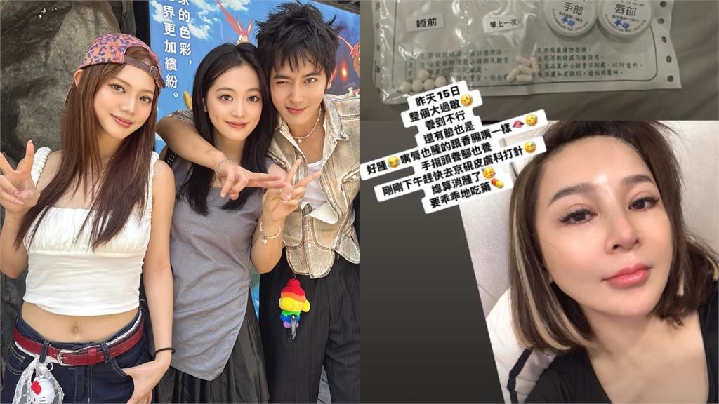 王彩樺「嘴唇腫成香腸」真相曝!現身惹「整形疑雲」她親上火線回應