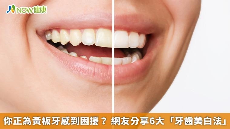 你正為黃板牙感到困擾？ 網友分享6大「牙齒美白法」