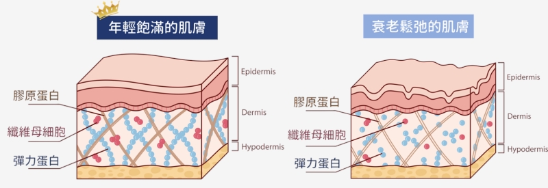 終結「饅化臉」危機！Profhilo逆時針、玻尿酸填充劑、水光針比一比
