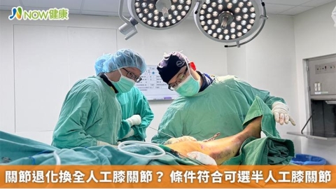 關節退化換全人工膝關節？ 條件符合可選半人工膝關節