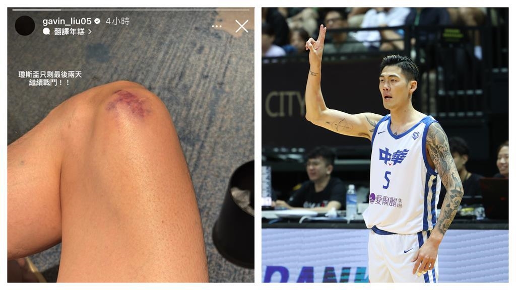 瓊斯盃／「台灣英雄」劉錚社群發出膝傷照！對自己喊話：繼續戰鬥