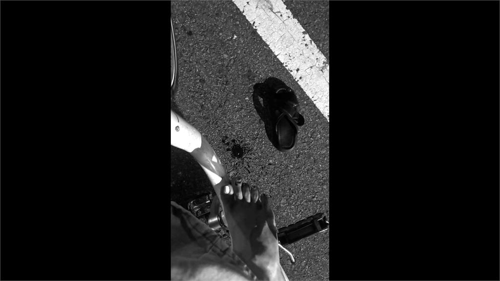 惡霸犬釀禍！新竹女騎腳踏車遇襲「腳趾甲掉落」爆血提告