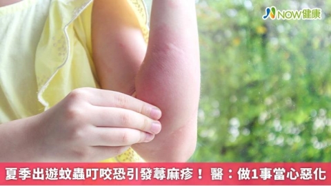 夏季出遊蚊蟲叮咬恐引發蕁麻疹! 醫:做1事當心惡化