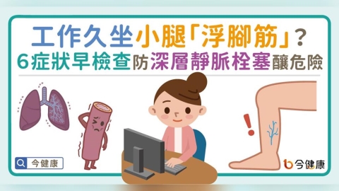 工作久坐腿部「浮腳筋」?6症狀早檢查,防深層靜脈栓塞釀危險。