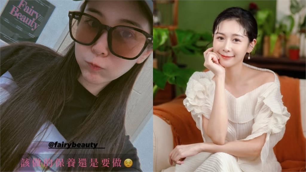 昔捲「賀瓏感情風波」Albee現身了！曬素顏照「真面目全公開」再洩近況