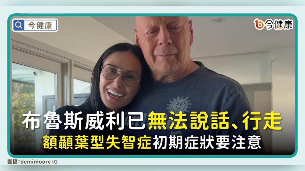 布魯斯威利已無法說話、行走。額顳葉型失智症初期症狀要注意