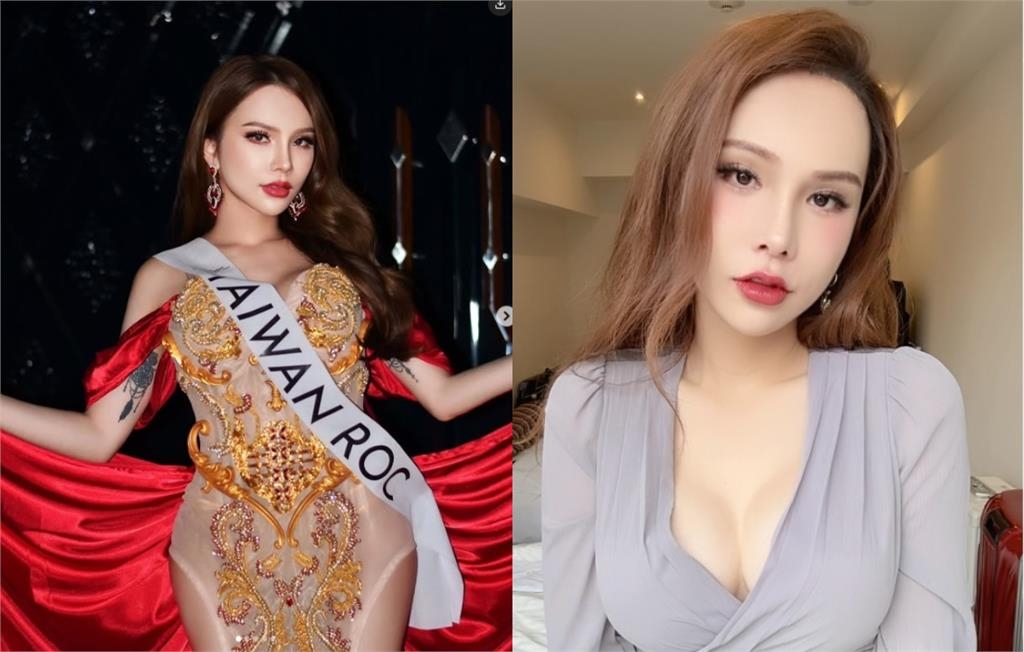 才爆激戰NBA球星嗨到撞斷牙！小A辣抖「砸500萬整型」內幕：不要醜到死