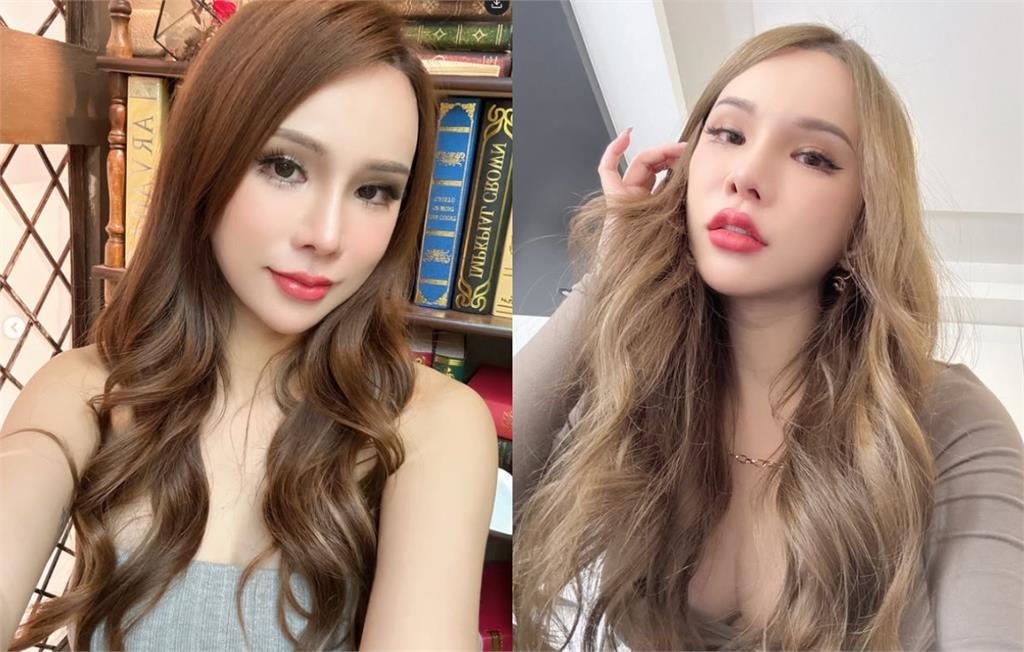 才爆激戰NBA球星嗨到撞斷牙！小A辣抖「砸500萬整型」內幕：不要醜到死