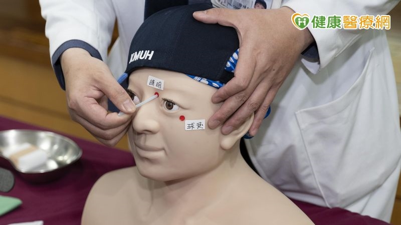 中醫「眼針療法」搭配西醫　解決40歲男「複視」困擾！