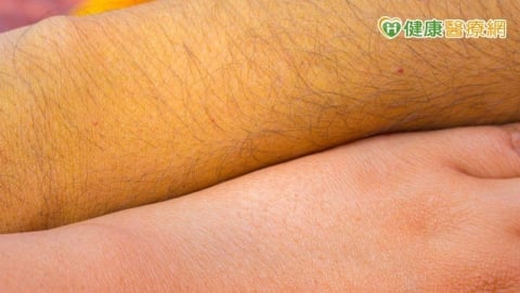 出現黃疸是肝病上身？　醫：皮膚還沒黃「這裡」就看出跡象