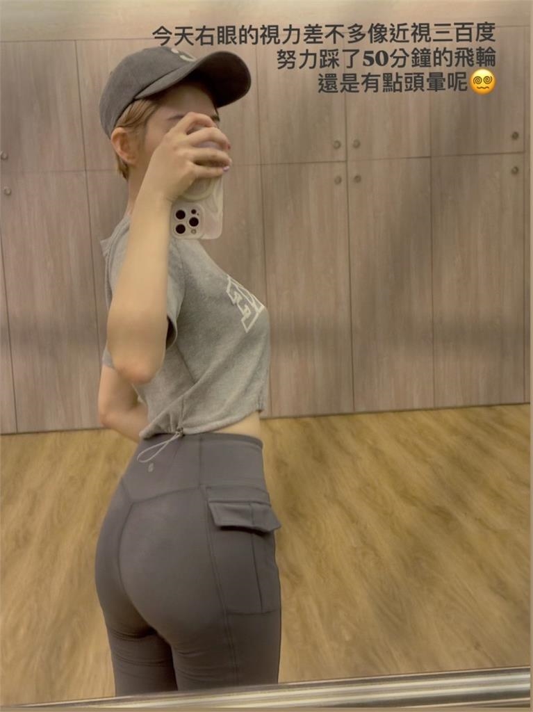 王晴微波蛋「慘炸左眼」最新近況曝 親媽1句認「不敢視訊」原因超鼻酸
