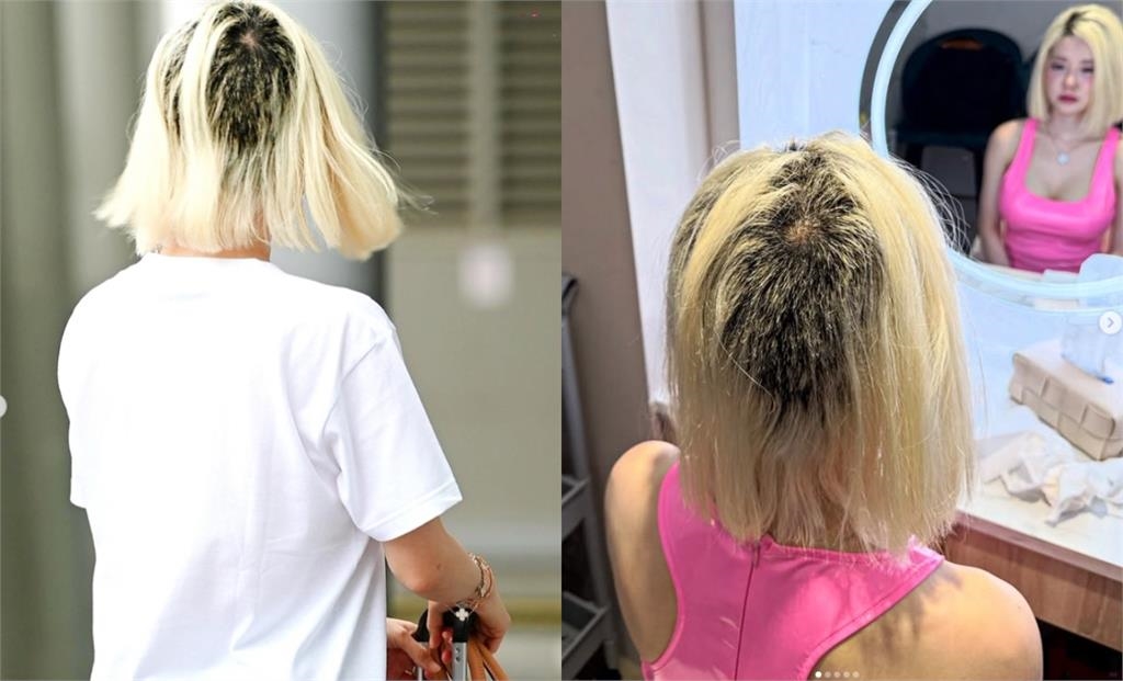 DJ SODA「狂掉髮剩10%」全因漂髮失敗！忍痛剃光慘況友看傻：像受虐的狗