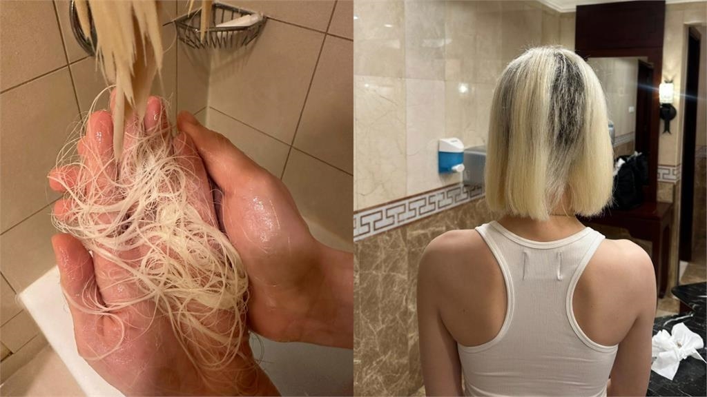 DJ SODA「狂掉髮剩10%」全因漂髮失敗！忍痛剃光慘況友看傻：像受虐的狗