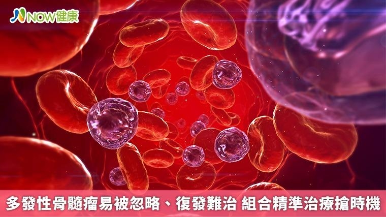 多發性骨髓瘤易被忽略、復發難治 組合精準治療搶時機