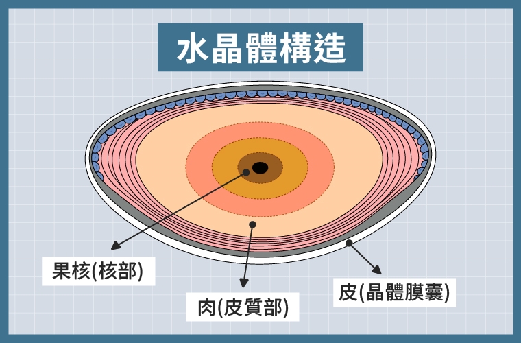 資深媒體人趙少康白內障逆轉戰 公開「抗白」心路歷程
