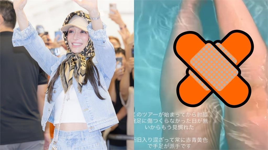 日本流行天后濱崎步睽違17年抵台 親曬「超赤裸入浴照」驚見小腿全是傷! 日本流行天后濱崎步睽違17年抵台 親曬「超赤裸入浴照」驚見小腿全是傷!
