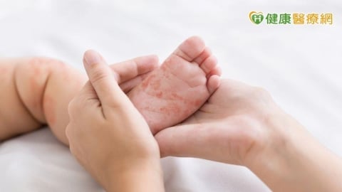 新生兒腸病毒重症新增2例　疾管署籲落實防疫、注意重症前兆
