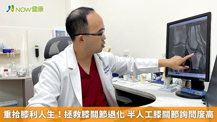 重拾膝利人生!拯救膝關節退化 半人工膝關節詢問度高 重拾膝利人生!拯救膝關節退化 半人工膝關節詢問度高
