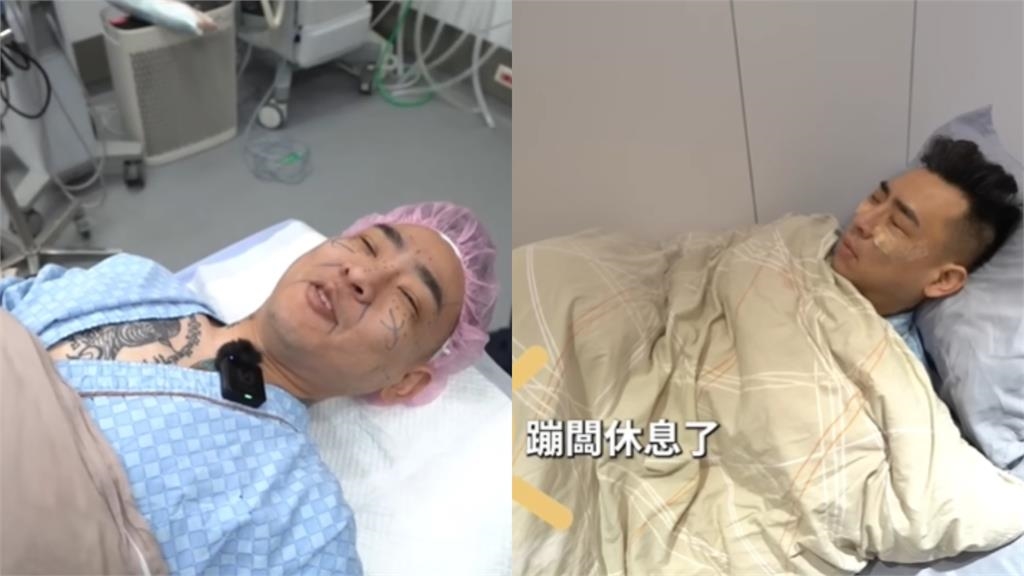 37歲蹦闆再進化!暴瘦狂甩45公斤「無預警突開刀」狠燒50萬近況曝