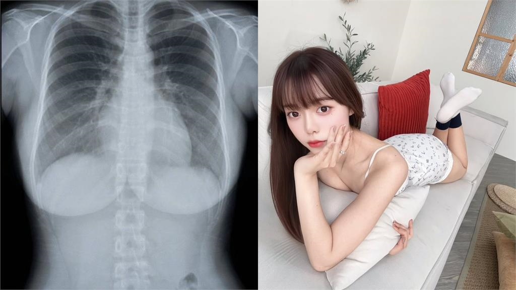 正妹網紅曬「高清無碼照」吸125萬人觀看！網友朝聖驚喊：太露骨了