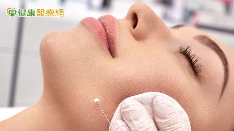 埋線拉提能逆齡？醫師揭線雕抗老真相