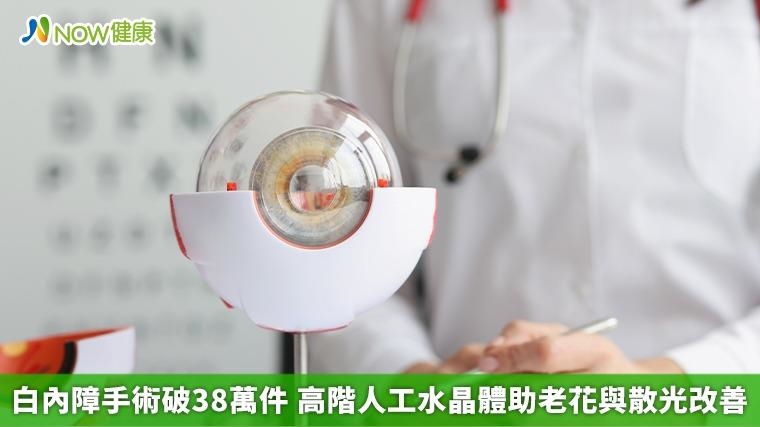 白內障手術破38萬件 高階人工水晶體助老花與散光改善