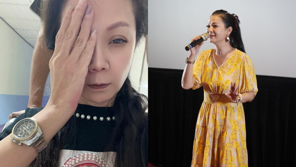 高欣欣凌晨出意外！老公急推輪椅送醫 嚴重傷勢曝光：眼前一片模糊