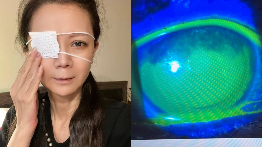 高欣欣凌晨出意外!老公急推輪椅送醫 嚴重傷勢曝光:眼前一片模糊
