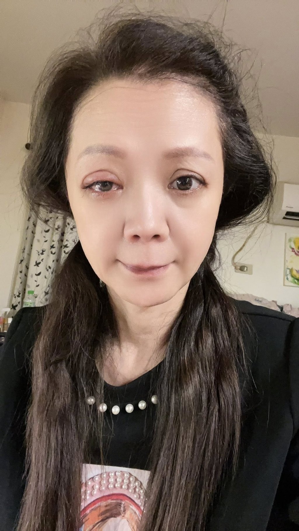 高欣欣凌晨出意外!老公急推輪椅送醫 嚴重傷勢曝光:眼前一片模糊