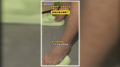 中國「屈公病」疫情失控　疾管署8/5公布是否升級旅遊警戒