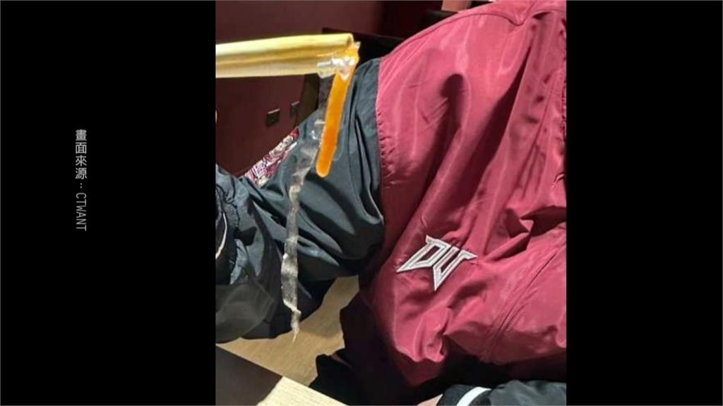 又出包？　球員餐有「死蒼蠅、活蛆」　樂天桃猿：要求廠商加強衛生