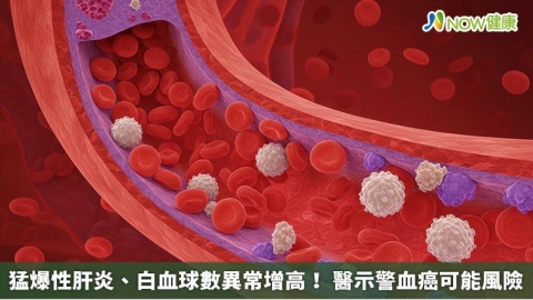 猛爆性肝炎、白血球數異常增高! 醫示警血癌可能風險