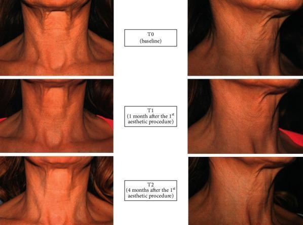一張含有 皮膚, 管風琴, 肉 的圖片 AI 產生的內容可能不正確。