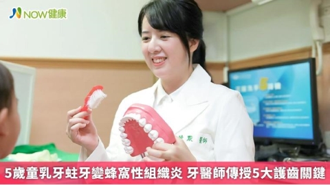 5歲童乳牙蛀牙變蜂窩性組織炎 牙醫師傳授5大護齒關鍵