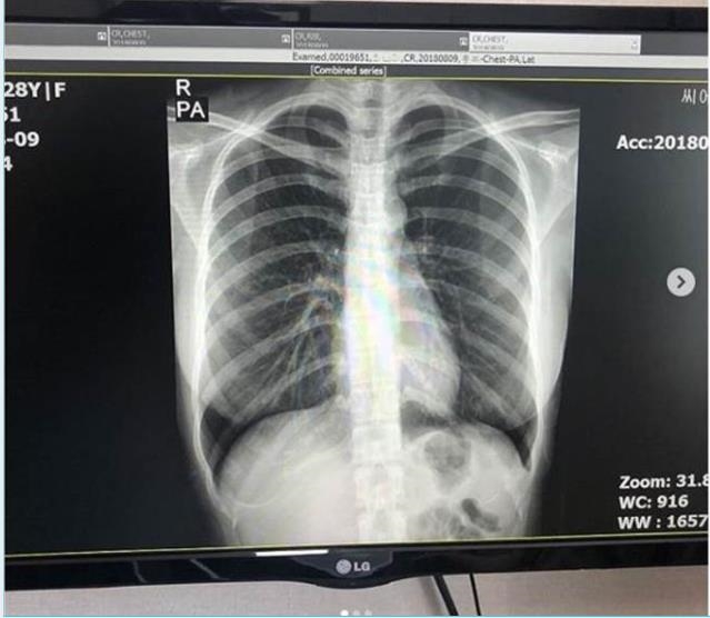 被指假胸「氣炸脫光拍照」上傳驗貨！南韓郭雪芙「薄紗亮點大走光」百萬人瘋看