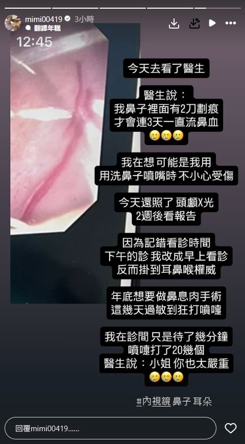 米可白鼻血狂流3天出事了！檢查驚見「鼻內兩條傷痕」預告年底將動刀