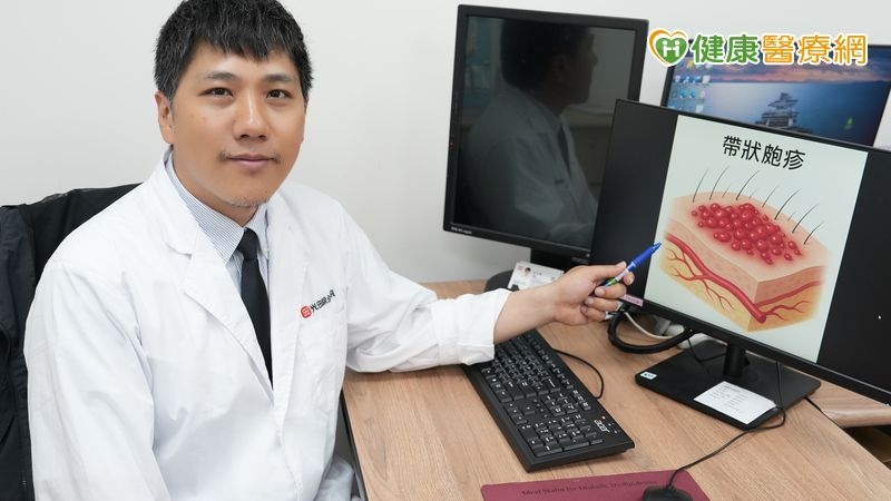 男側腹痛掛泌尿科無異常 三天後出紅疹痛到難眠才知「皮蛇」上身